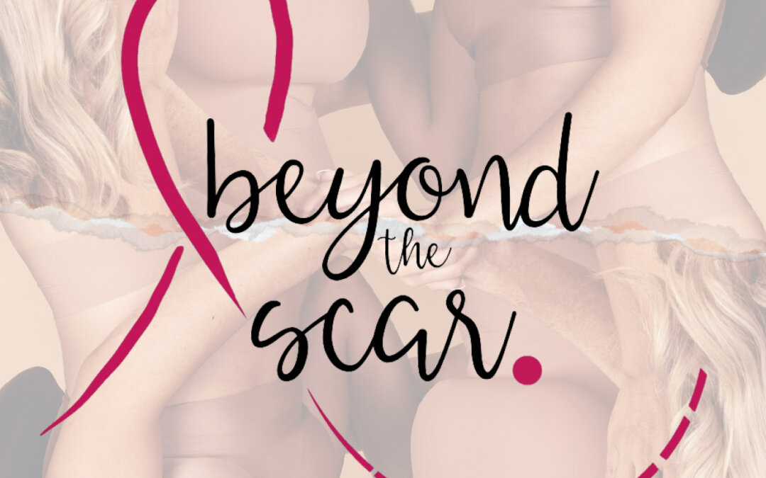 Beyond the Scar Fashion Show: A Resounding Success